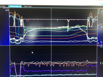 Hill Climb Datalog Knock Sensor Activity Post 3D Smoothing.JPG